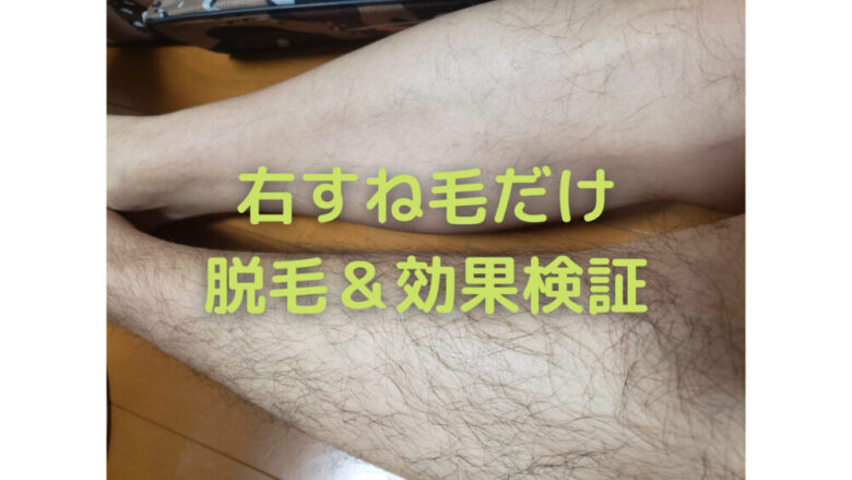 ケノンで右すね毛だけ脱毛した結果 3か月の経過画像30枚 しょーてぃブログ ケノンで右すね毛だけ脱毛した結果 3か月の経過画像30枚 しょーてぃブログ
