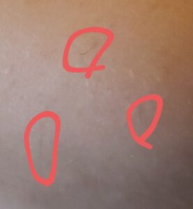 ケノン使用後2年生えてくる