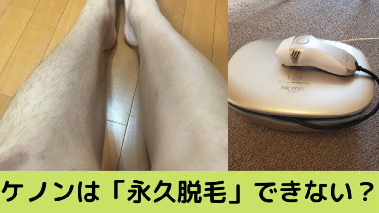 家庭用脱毛器ケノンでは永久脱毛できない 口コミ 写真つきで解説 しょーてぃブログ 家庭用脱毛器ケノンでは永久脱毛できない 口コミ 写真つきで解説 しょーてぃブログ